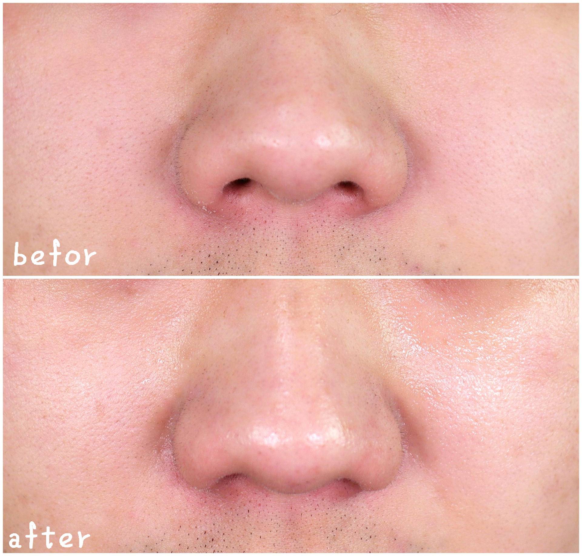 朗仕保湿焕能精华凝露,清爽凝露