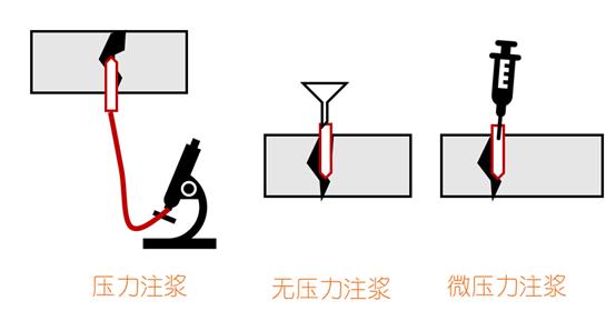 楼板裂缝怎么处理最彻底,楼板裂缝用什么方法解决最好