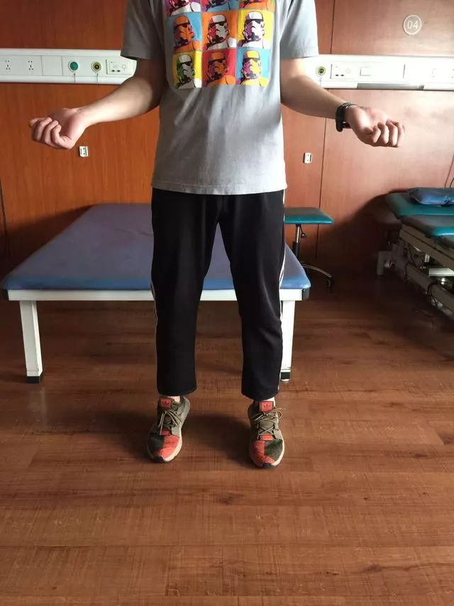 预防运动损伤的意义,预防运动损伤最佳方法