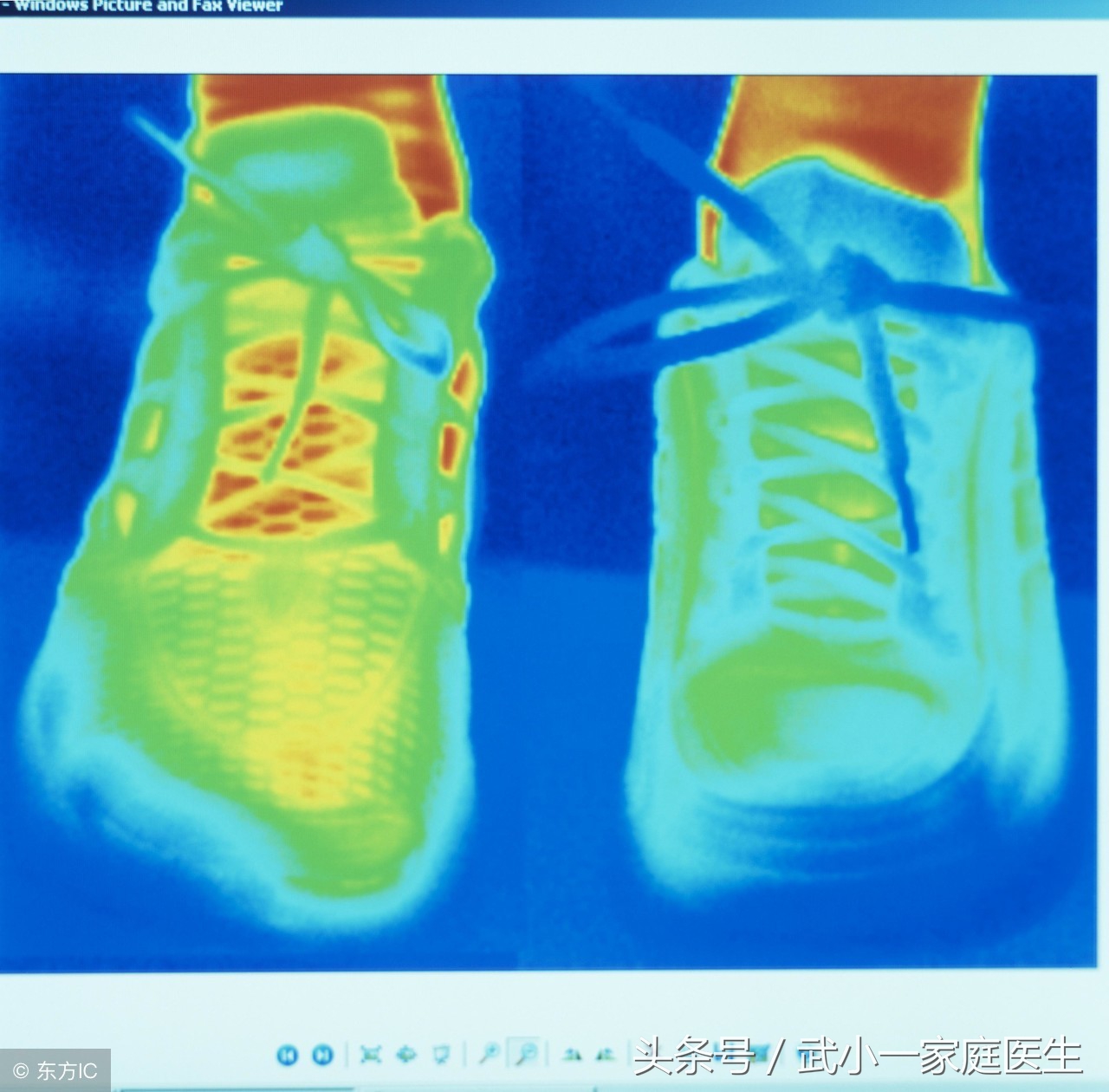 我终于战胜了懒惰,我终于战胜了牛皮癣
