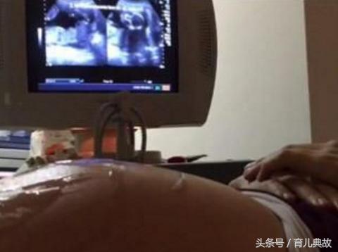 怀孕8个月肚子突然“变硬”,孕妈哭的稀里哗啦,医生却无奈了