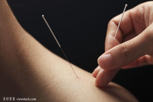 常用穴位处方一览表,人体自带的穴位处方