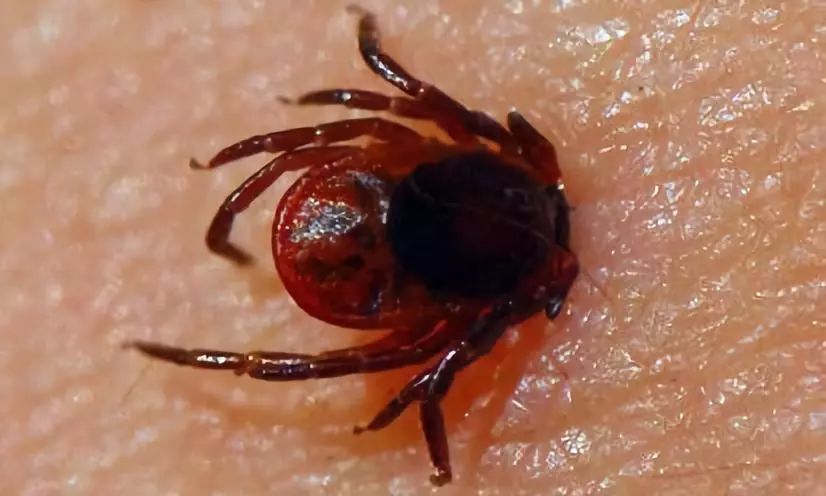 潍坊所有的家长,这种虫子传播新型艾滋病,最喜欢叮咬孩子……