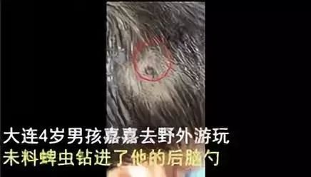 潍坊所有的家长,这种虫子传播新型艾滋病,最喜欢叮咬孩子……