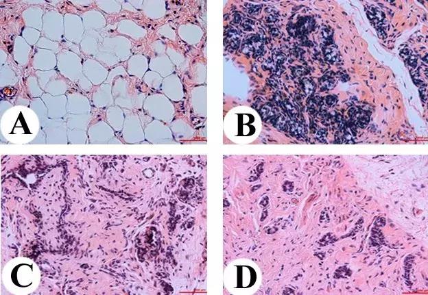 李春义|身边人备受乳腺增生、前列腺增生的困扰,您想过尝试药食同源的鹿角盘粉吗?
