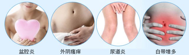 100万日本女性免受妇科病困扰的标配,就是Ta~