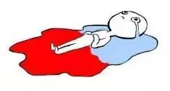 100万日本女性免受妇科病困扰的标配,就是Ta~