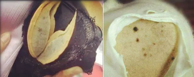 100万日本女性免受妇科病困扰的标配,就是Ta~