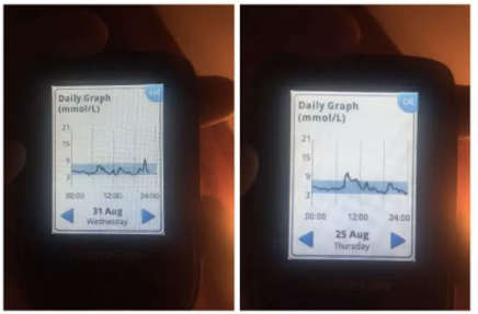 糖尿病蜜月期结束的预兆是什么呢,糖尿病蜜月期是什么意思