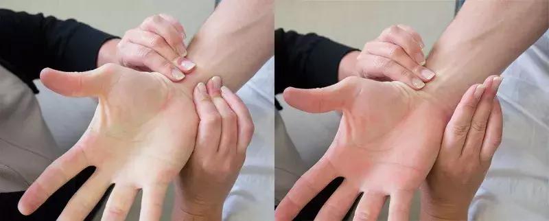 如何提高采动脉血技巧,手术前为什么要采动脉血