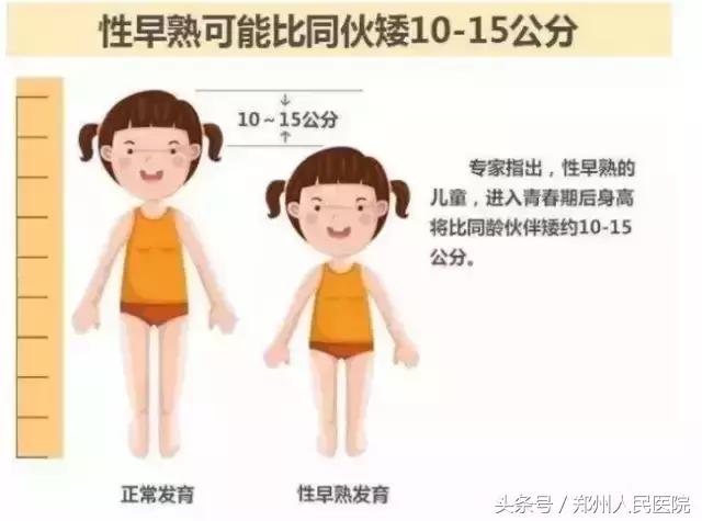 11岁男孩变声长胡须还会再长吗,9岁男孩长出小胡子正常吗