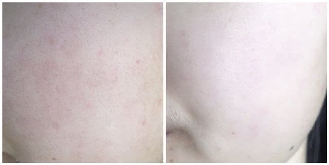 绝不外传的抗皱方法,抗皱回春的秘诀