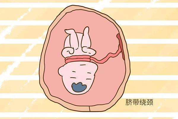 宫内暂时缺氧后面还会一直缺氧吗,宫内缺氧如何查出来是否缺氧