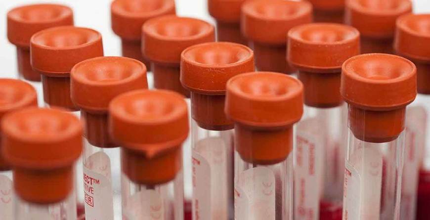 怀孕tsh促甲状腺激素3.7,怀孕初期tsh促甲状腺激素3.68高