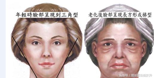 浅谈面部五层提升为什么能更好的解决面部松弛下垂