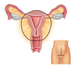 宫颈糜烂要用药吗？治好了还要做宫颈癌筛查吗？
