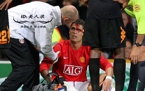 c罗被打满脸是血是哪一次,眼角被撞出血了一定要缝针么