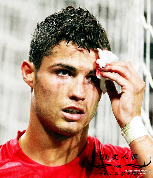 c罗被打满脸是血是哪一次,眼角被撞出血了一定要缝针么