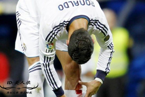 c罗受过最重的伤视频,c罗那些年欧冠