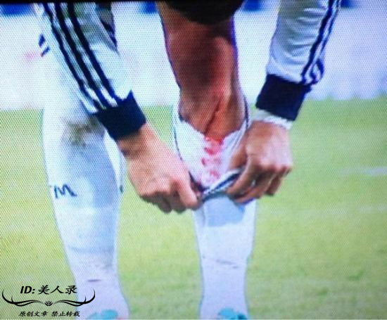 c罗受过最重的伤视频,c罗那些年欧冠