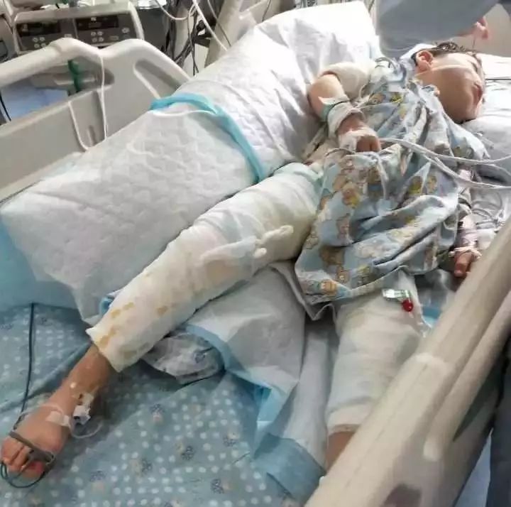 小孩被电动车充电口电伤,小孩子被电瓶车充电口电击