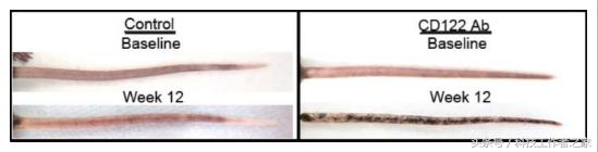 厉害!抹掉T细胞的记忆或能逆转白癜风症状