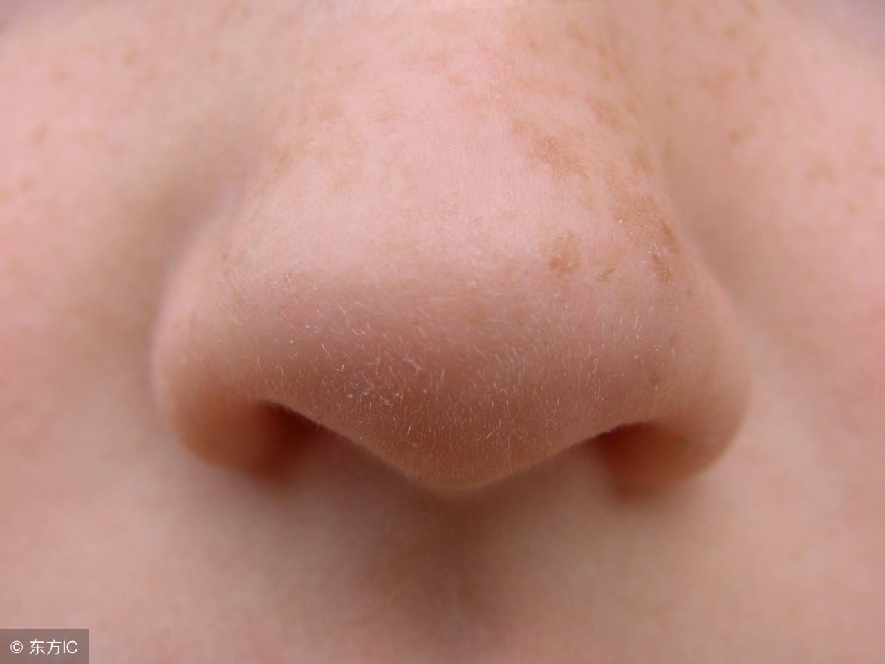鼻子上的黑头挤压过程,鼻子上黑头怎么去掉学生