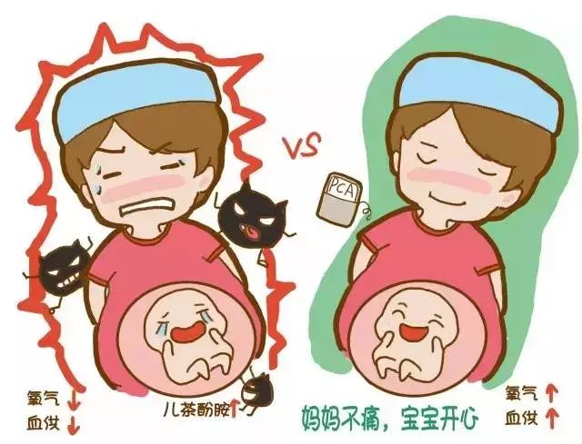 无痛分娩多少钱,无痛分娩大揭秘让你轻松做妈妈