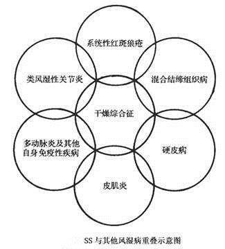 口干眼干，上火还是手机看太多？不，你可能得了“干燥综合征”