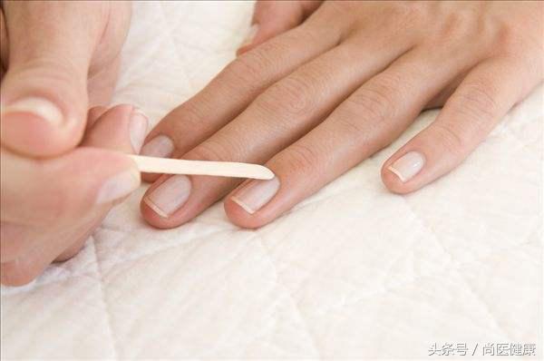 灰指甲不吃药怎么治疗能彻底根除,灰指甲吃药怎么治疗能彻底根除