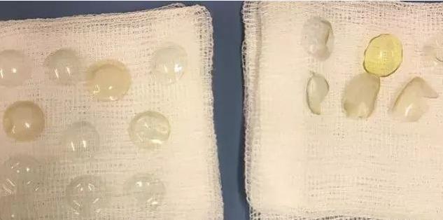 经常戴隐形眼镜有什么不好,为什么戴隐形眼镜一开始会辣眼睛