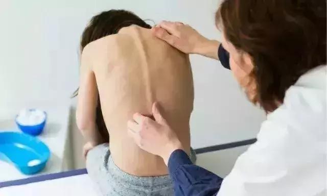 23岁姑娘撩起上衣，妈妈一看急疯了！暑假孩子一窝蜂看这病，再晚要吃大苦头！