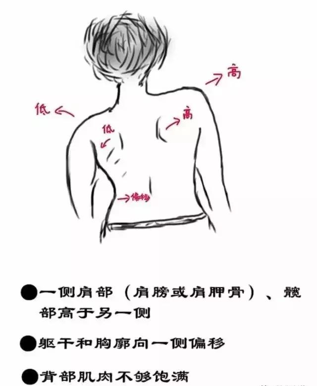 23岁姑娘撩起上衣，妈妈一看急疯了！暑假孩子一窝蜂看这病，再晚要吃大苦头！