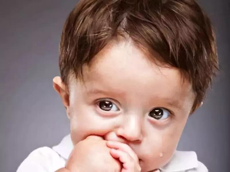 小孩汗疱疹脱皮怎么治疗,孩子手脱皮汗疱疹怎么解决