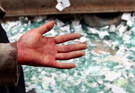 玻璃钢毛刺扎手怎么处理,玻璃丝扎手怎么解决