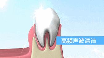 抖音卖爆电动牙刷,卖爆了的牙刷