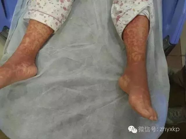 药品过期就一定失效吗,药品过期了还能丢吗