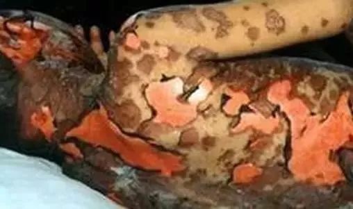 药品过期就一定失效吗,药品过期了还能丢吗