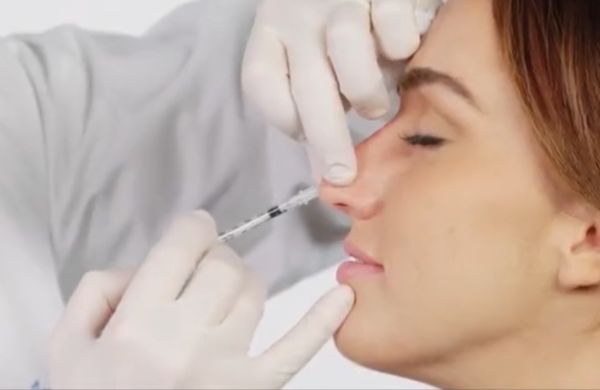 做了鼻子感觉显老十岁怎么办,做了鼻子显老显人中长