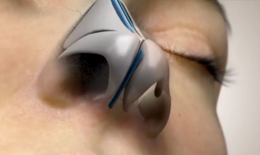 做了鼻子感觉显老十岁怎么办,做了鼻子显老显人中长