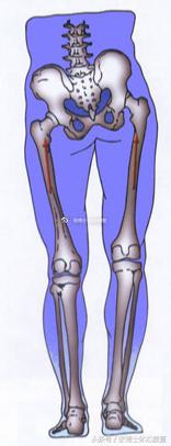矫正长短腿去哪里矫正,体态矫正腿
