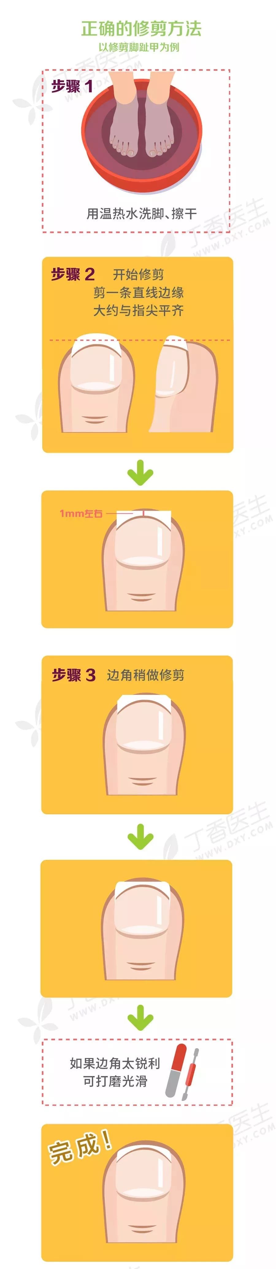 指甲剪太钝了怎么办,指甲剪太进去很痛怎么办