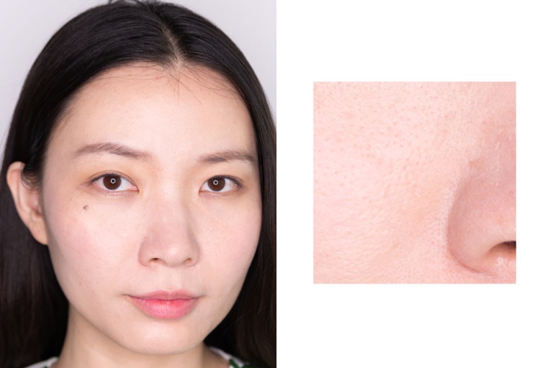 28天解决了所有皮肤问题,你猜我做了些什么?