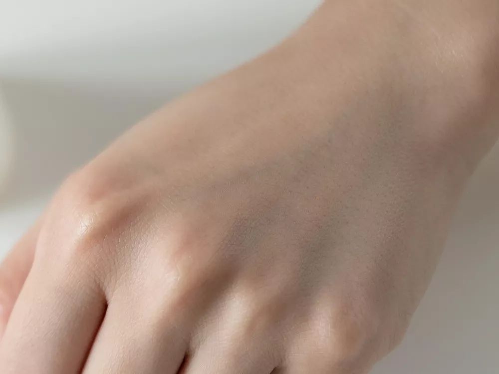 28天解决了所有皮肤问题,你猜我做了些什么?