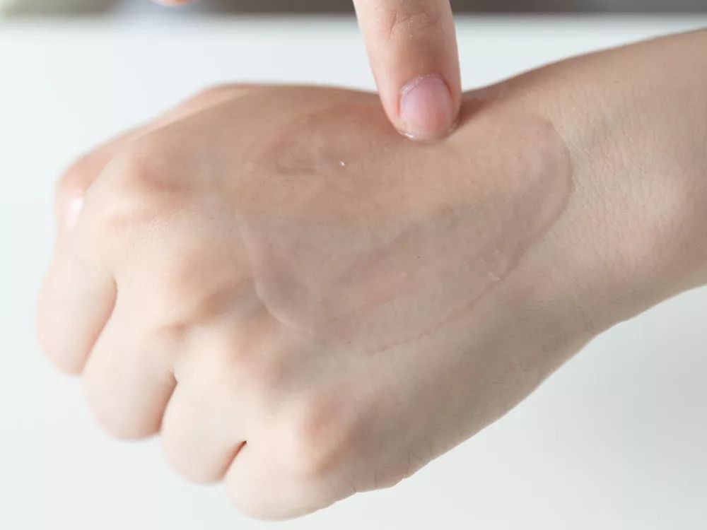 28天解决了所有皮肤问题,你猜我做了些什么?