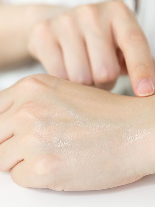 28天解决了所有皮肤问题,你猜我做了些什么?