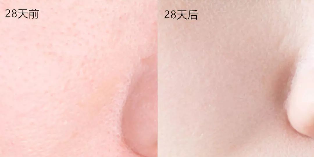 28天解决了所有皮肤问题,你猜我做了些什么?
