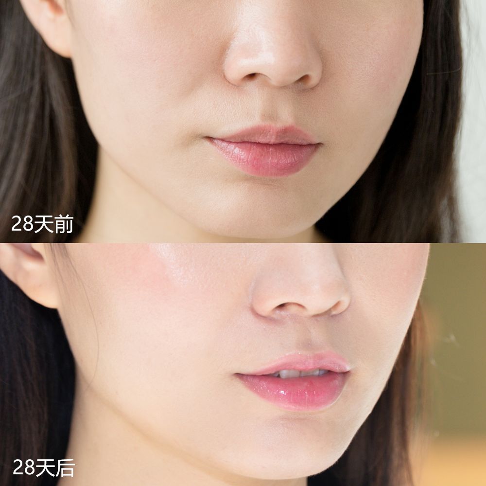 28天解决了所有皮肤问题,你猜我做了些什么?
