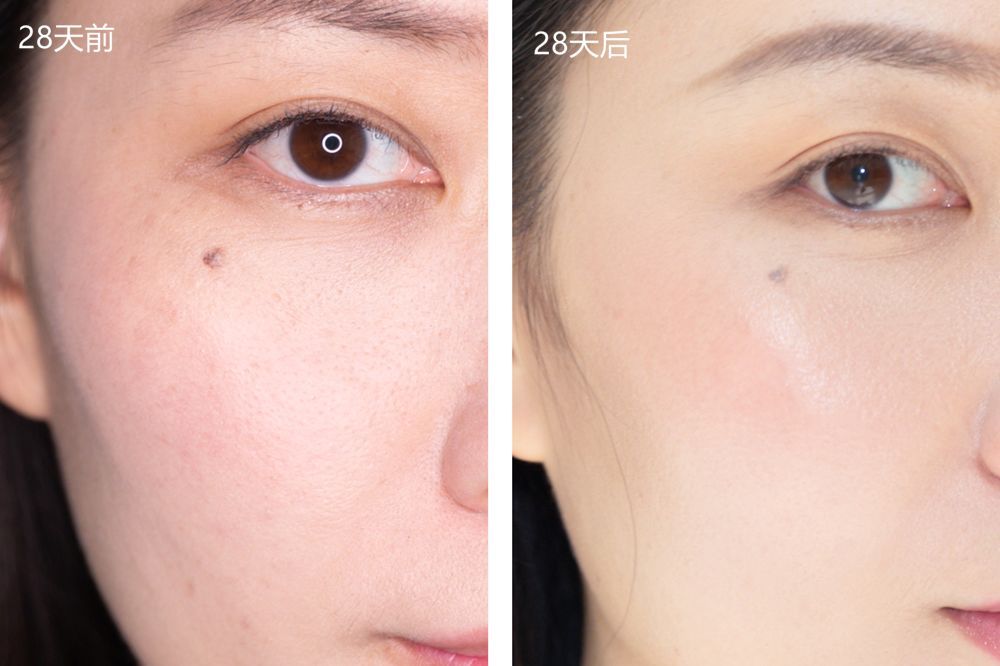 28天解决了所有皮肤问题,你猜我做了些什么?