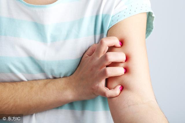 三种湿疹,十种湿疹不能治好